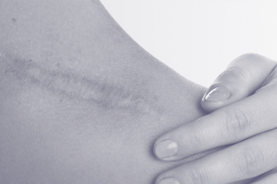 cirugia-reconstructiva